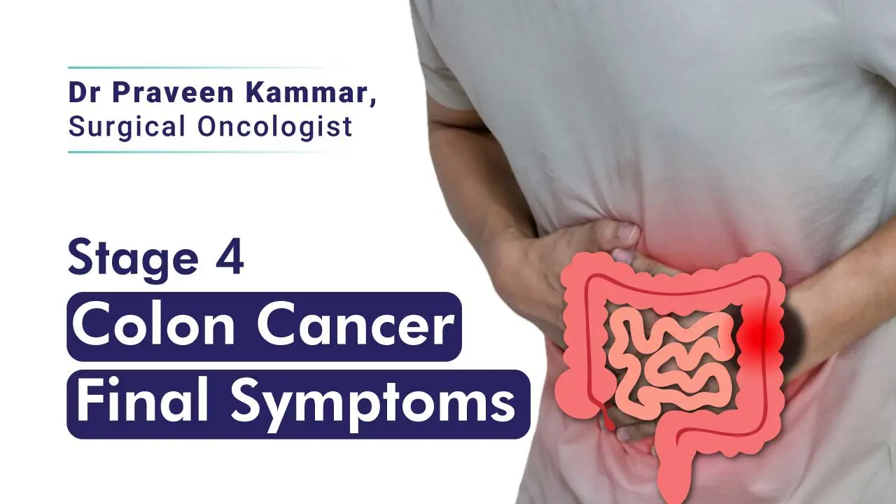 Stage 4 colon cancer symptoms include blood in stool, abdominal pain, weight loss, and fatigue. Detecting these signs early is crucial for effective treatment and management.