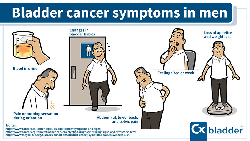 Male bladder cancer symptoms include blood in urine, frequent urination, pain during urination, and lower back pain. Bladder cancer symptoms in men can vary in intensity and may indicate the need for further medical evaluation.