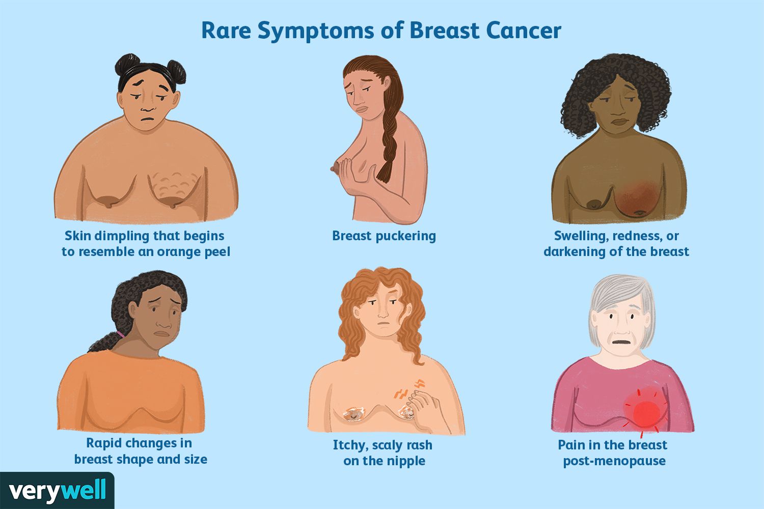 Breast cancer symptoms can include pain and itching. It is important to seek medical attention if these symptoms persist.