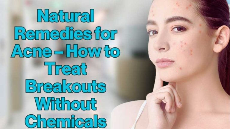 Natural Remedies for Acne – How to Treat Breakouts Without Chemicals