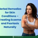 Herbal Remedies for Skin Conditions – Treating Eczema and Psoriasis Naturally